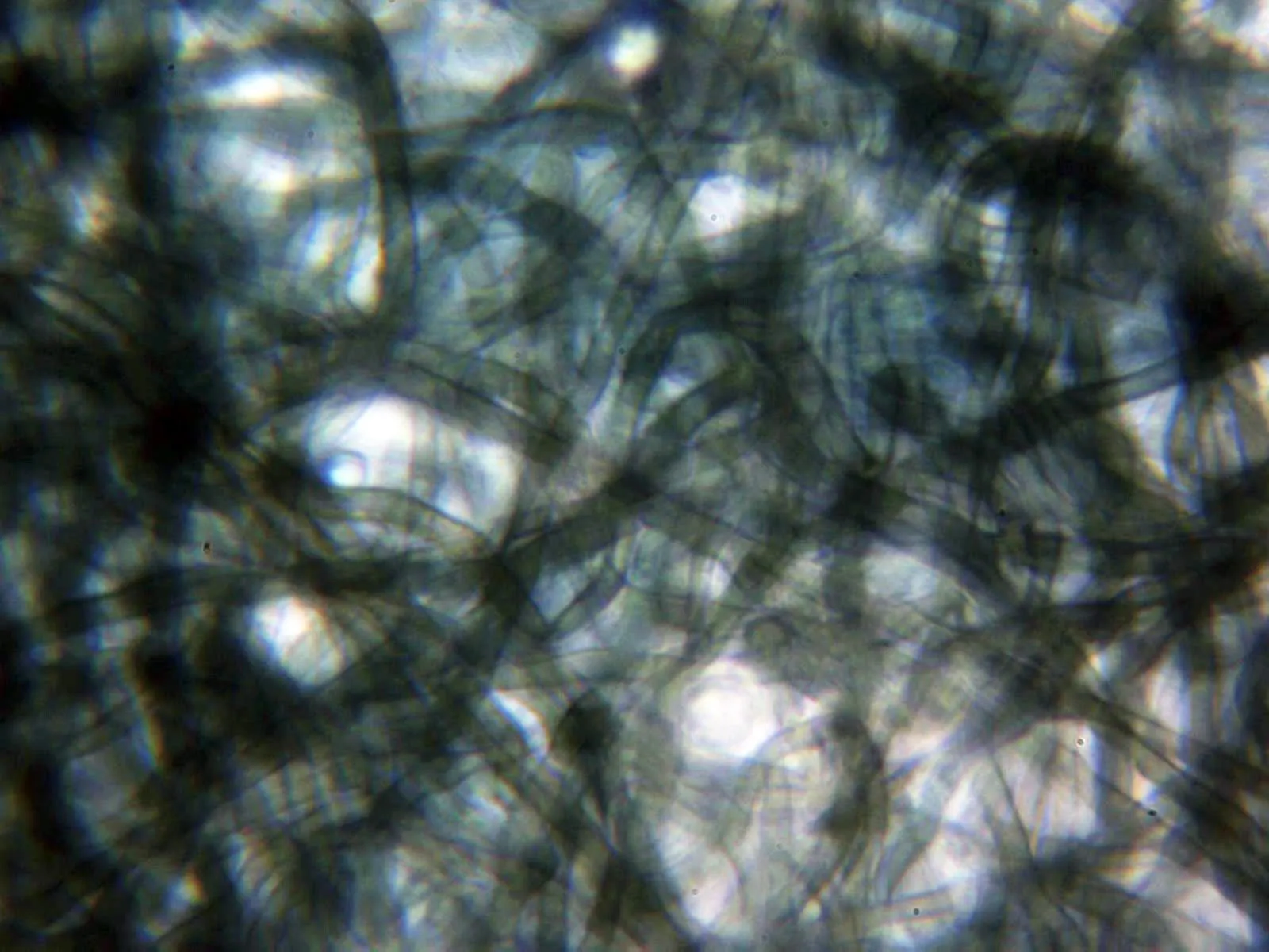 Microscopía de Pseudotomentella nigra - 10 - Contexto KOH sin fibulas